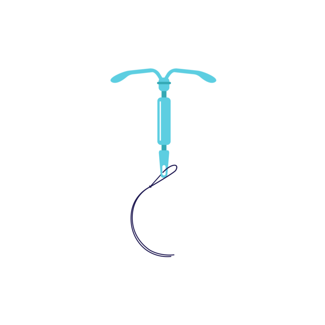 This is what an IUD can look like